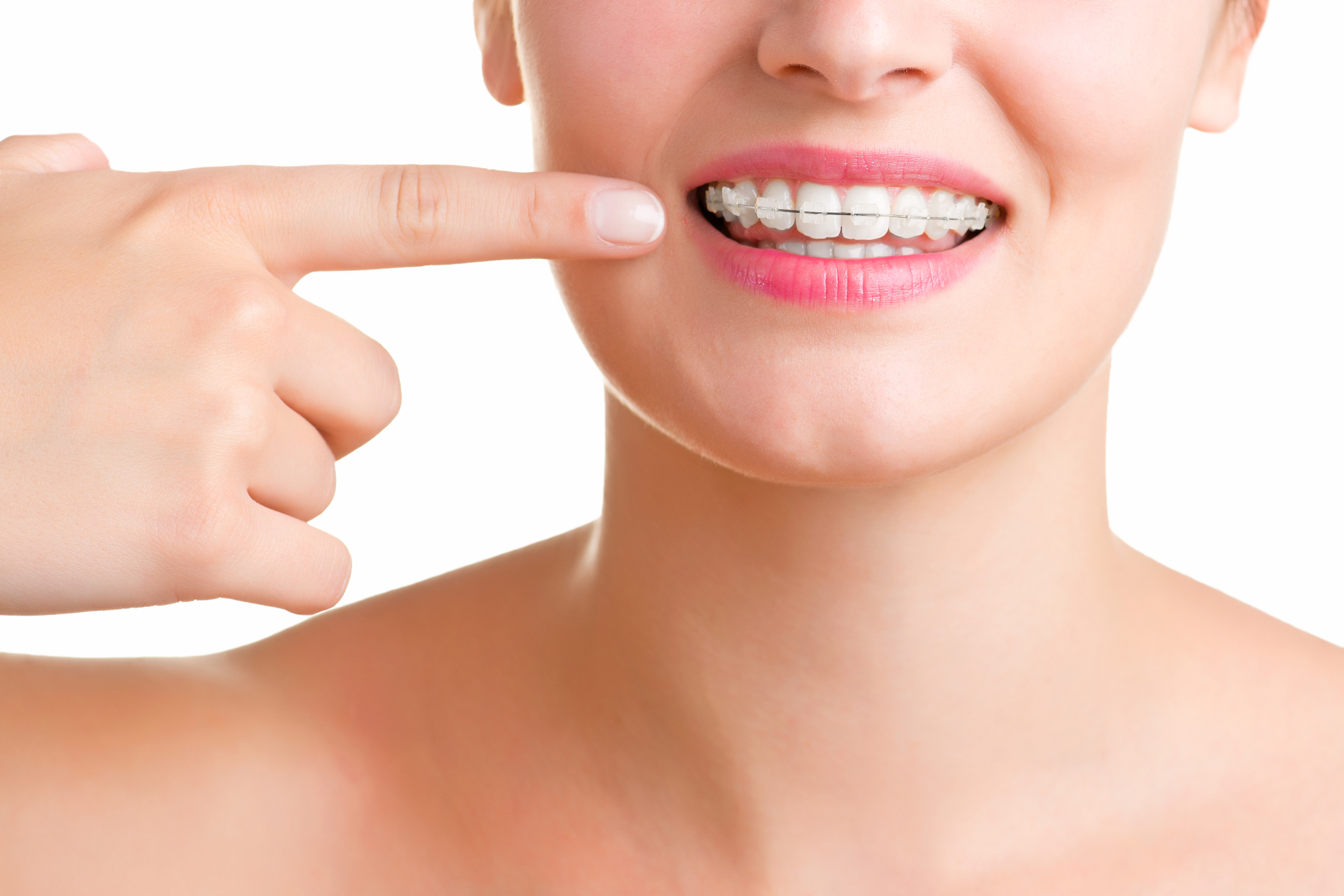 Zobni aparat nam bo pomagal pri raznih nepravilnostih zobovja